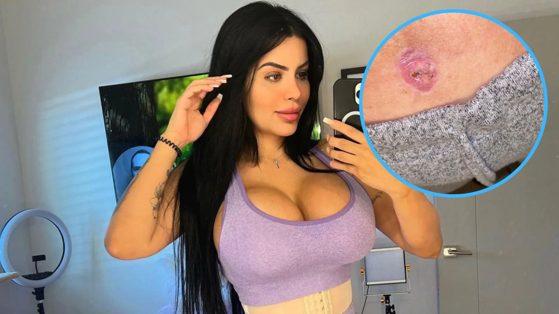 90 day fiances larissa dos santos limas plastic surgery journey from liposuction to botched procedure